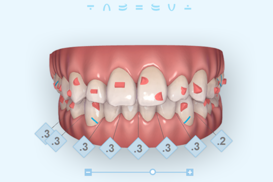 矯正治療の検査 - SkyDentalClinic（亀岡市）